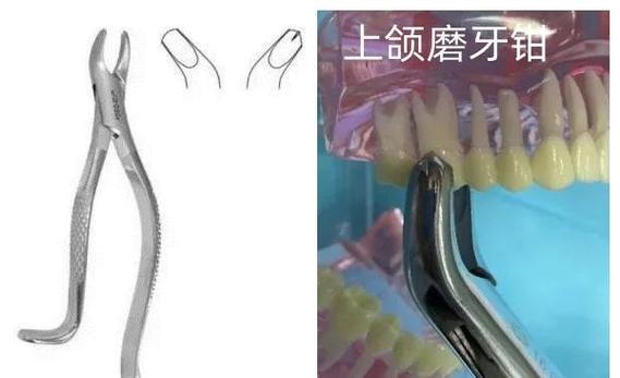 牙器械分离后,如何选择科学有效的处理方法?-图2 牙器械分离后,如何选择科学有效的处理方法?-图2