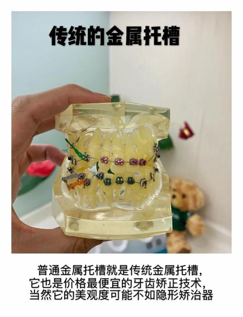 蓝胶如何粘接正畸托槽?操作步骤与技巧详解-图3 蓝胶如何粘接正畸托槽?操作步骤与技巧详解-图3