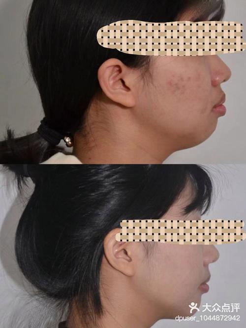 北京瑞泰口腔医院正畸怎么样?选择要注意啥?-图2 北京瑞泰口腔医院正畸怎么样?选择要注意啥?-图2