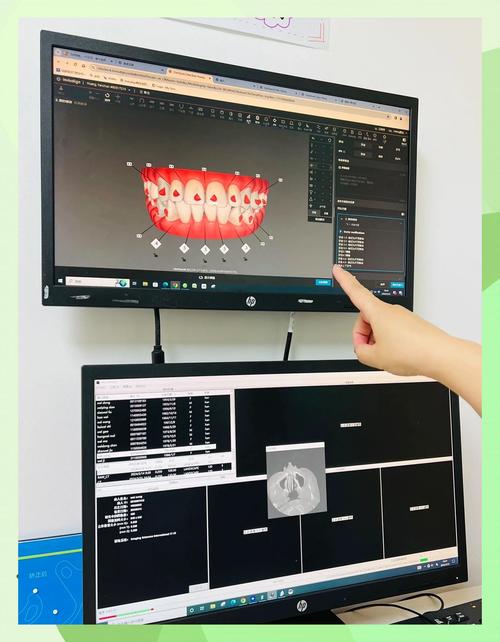 北京瑞泰口腔医院正畸怎么样?选择要注意啥?-图1 北京瑞泰口腔医院正畸怎么样?选择要注意啥?-图1