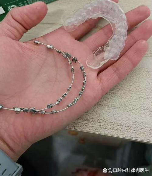 种牙与邻牙间有缝隙，是什么原因导致的？-图2