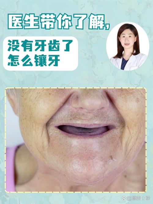 牙槽骨少还能种牙吗？专家解答可行方案-图3