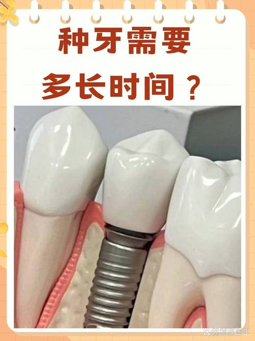 夏季种牙,牙缺失者需注意什么?时机、护理全解析!-图2 夏季种牙,牙缺失者需注意什么?时机、护理全解析!-图2