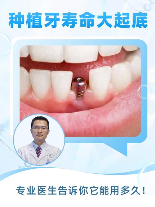 种牙后多久可以装牙?装牙时间受哪些因素影响?-图3 种牙后多久可以装牙?装牙时间受哪些因素影响?-图3