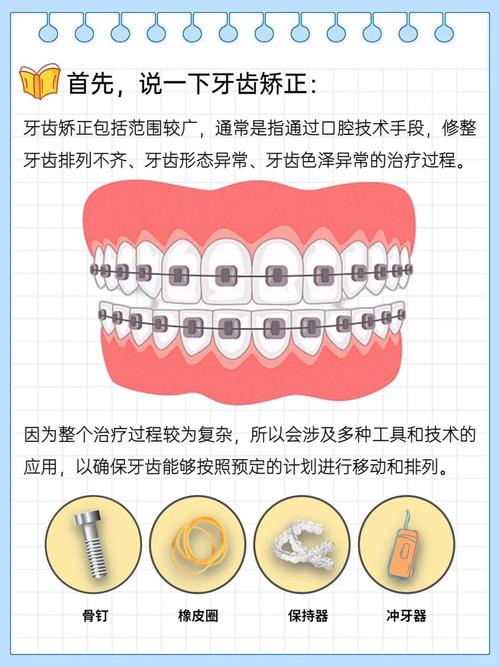 正畸辅助治疗方法有哪些?各自适用于哪些矫正需求?-图1 正畸辅助治疗方法有哪些?各自适用于哪些矫正需求?-图1