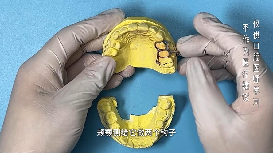 如何有效压低单个磨牙?具体方法与操作步骤有哪些?-图1 如何有效压低单个磨牙?具体方法与操作步骤有哪些?-图1
