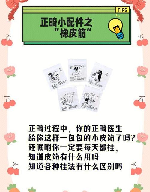 牙科正畸橡皮圈的作用具体有哪些？-图2