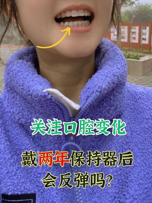 正畸会让舌头放不下吗-图1 正畸会让舌头放不下吗-图1