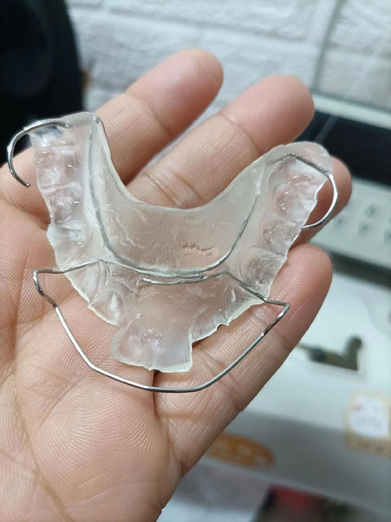 正畸活动式矫正器图片主要展示哪些佩戴效果与类型？-图2