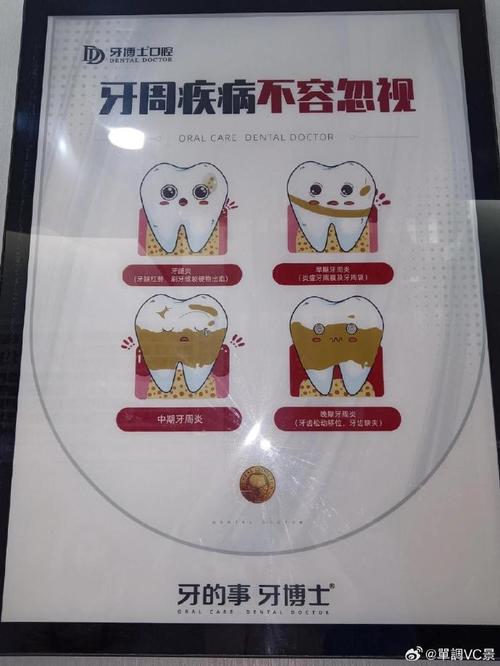 温州牙科牙博士的治疗方法效果如何?安全吗?有什么优势?-图1 温州牙科牙博士的治疗方法效果如何?安全吗?有什么优势?-图1