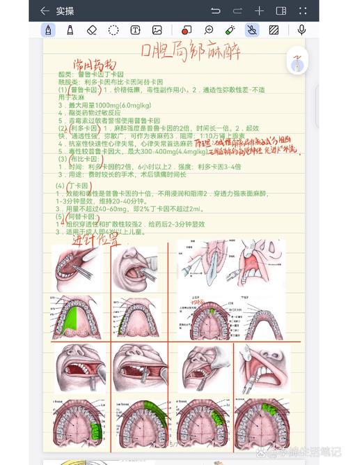 口腔局麻方法有几种？常见类型、适用范围及临床应用详解-图1