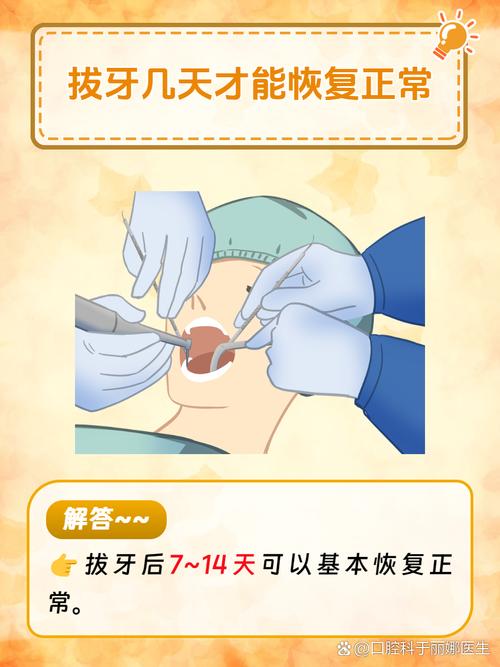 拔牙后多久可以种牙?-图3 拔牙后多久可以种牙?-图3