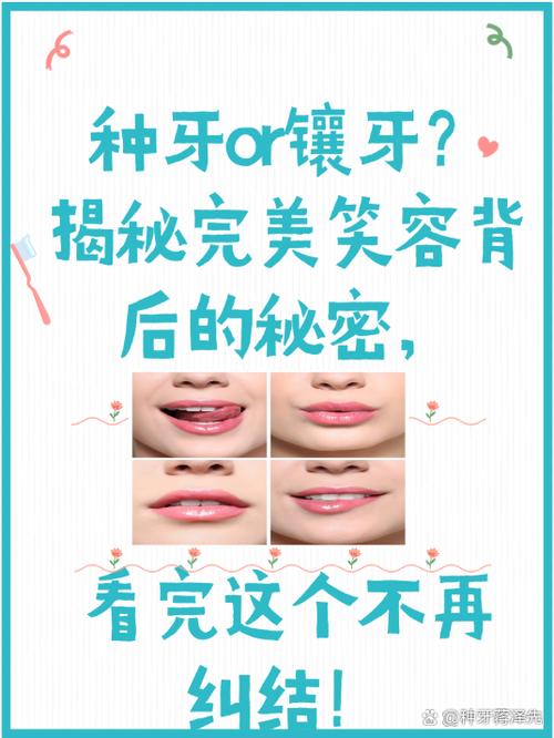 缺一颗牙镶牙还是种牙？哪种方式更适合？如何科学选择？-图3