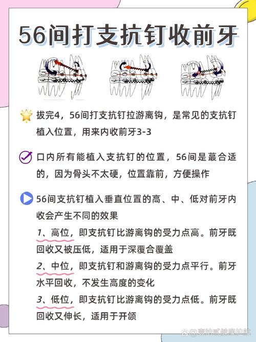 如何有效增加前牙支抗?实用方法有哪些?-图1 如何有效增加前牙支抗?实用方法有哪些?-图1