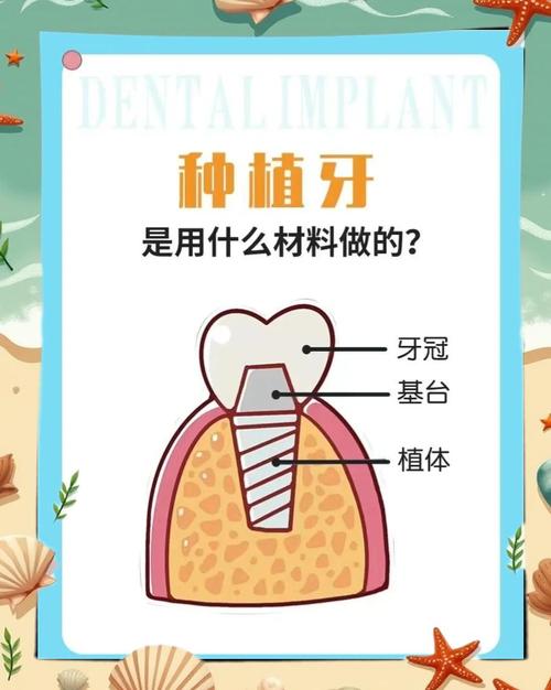 种牙的牙基础的材质-图2 种牙的牙基础的材质-图2