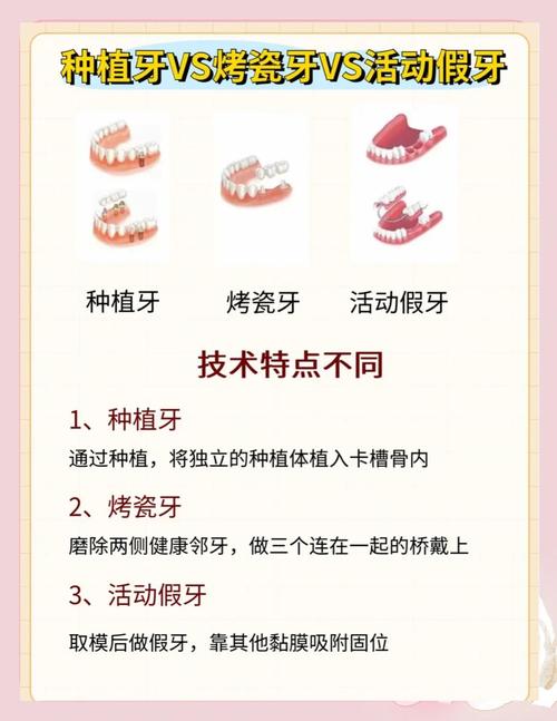 义齿缺失的分类方法主要有哪些?不同类型如何区分?-图2 义齿缺失的分类方法主要有哪些?不同类型如何区分?-图2