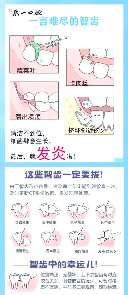 去除智齿的最佳方法是什么?拔牙、微创哪种更安全?如何选择适合自己的?-图1 去除智齿的最佳方法是什么?拔牙、微创哪种更安全?如何选择适合自己的?-图1