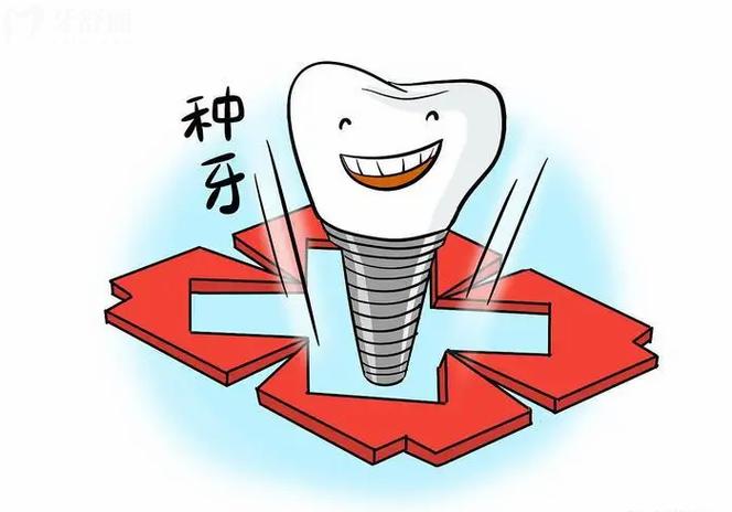 满口种牙为何首推牙管家?-图1 满口种牙为何首推牙管家?-图1