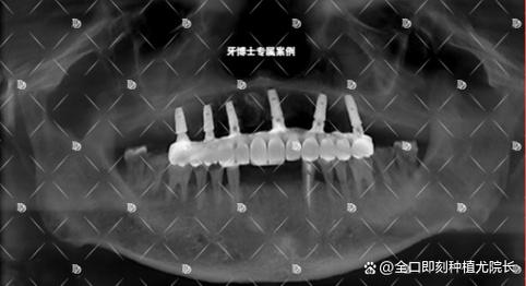 太仓牙博士种牙好吗？效果、价格、口碑、技术怎么样？-图1