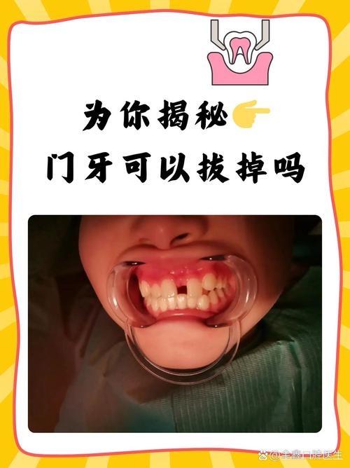 打开牙关最好的方法是什么?-图3 打开牙关最好的方法是什么?-图3