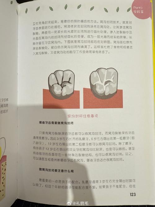 无牙颌口底封闭方法关键临床操作步骤与效果如何？-图3