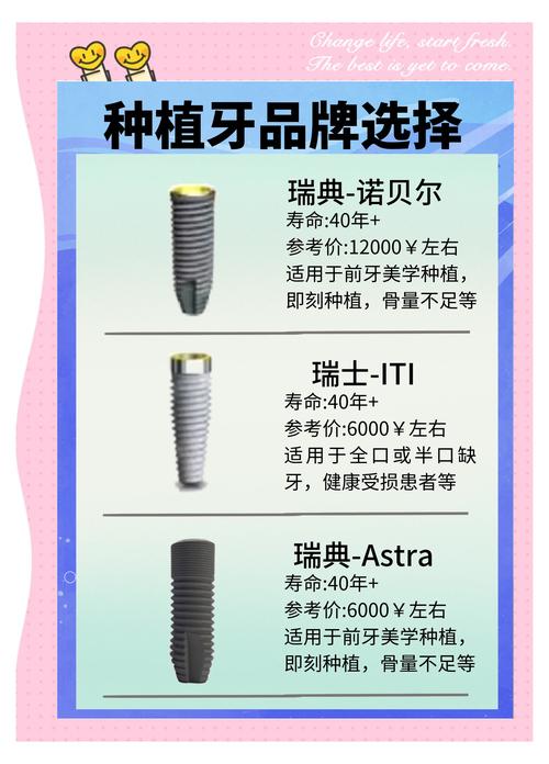 种植牙哪种比较好？不同品牌/技术怎么选？-图1