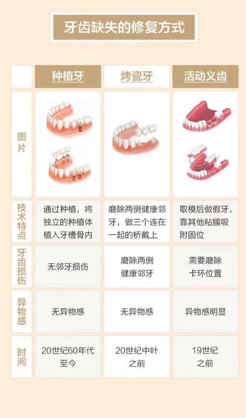 牙齿缺失的标示方法有哪些?临床如何规范应用?-图1 牙齿缺失的标示方法有哪些?临床如何规范应用?-图1