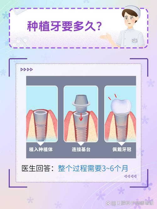 种牙二期完成后,还要等多久才能正常使用牙齿?-图1 种牙二期完成后,还要等多久才能正常使用牙齿?-图1