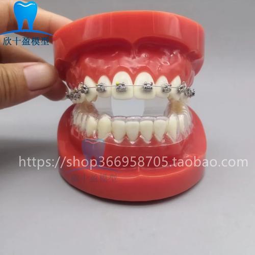 正畸医院会保留患者的牙模吗？-图2