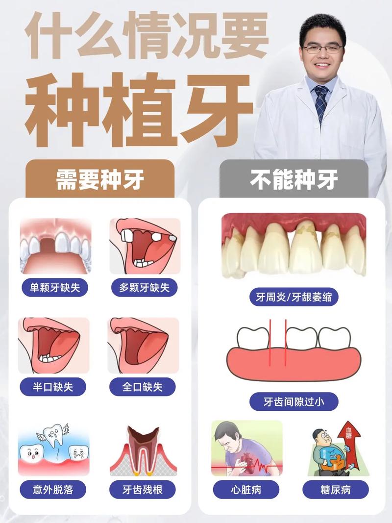 什么情况下适合种牙?种植牙需满足哪些条件?-图1 什么情况下适合种牙?种植牙需满足哪些条件?-图1