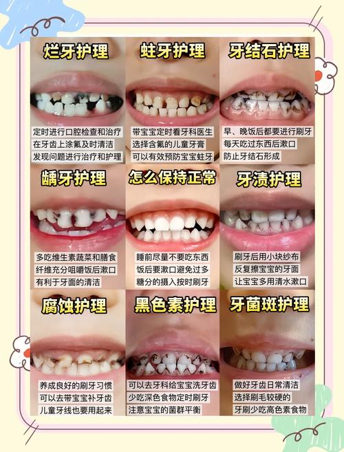 色素牙怎么处理？有哪些有效方法？-图3