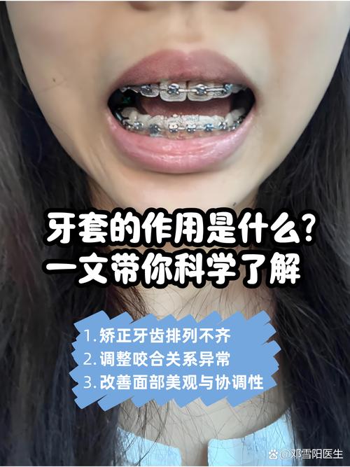 正畸佩戴牙托槽会引起头痛吗？这种不适感是正常现象吗？-图2