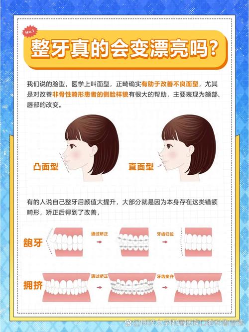 牙齿有缝正畸最短多久能闭合？-图1