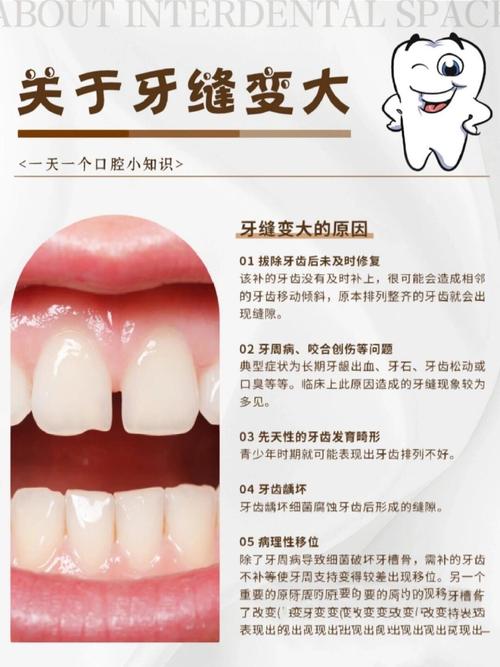 牙齿有缝正畸最短多久能闭合?-图3 牙齿有缝正畸最短多久能闭合?-图3
