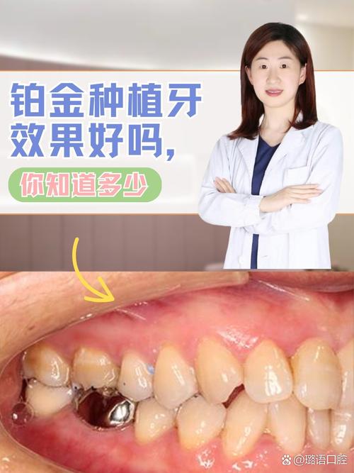 种牙是什么材料好？不同材质的优缺点和选择建议？-图1