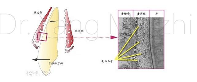 咬合创伤的治疗方法有哪些?-图3 咬合创伤的治疗方法有哪些?-图3