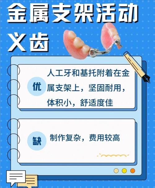 活动义齿设计方法的关键步骤与原则有哪些？-图2