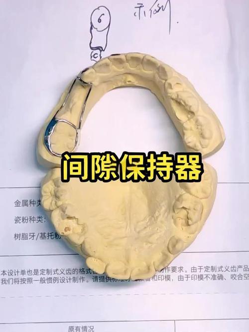 儿童正畸保持器选哪种？不同类型适用情况有何差异？医生建议如何科学选择？-图2