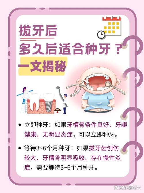 即拔即种牙周期多久-图1 即拔即种牙周期多久-图1