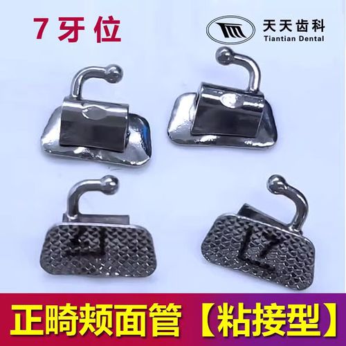 正畸焊接用的什么材料-图2 正畸焊接用的什么材料-图2