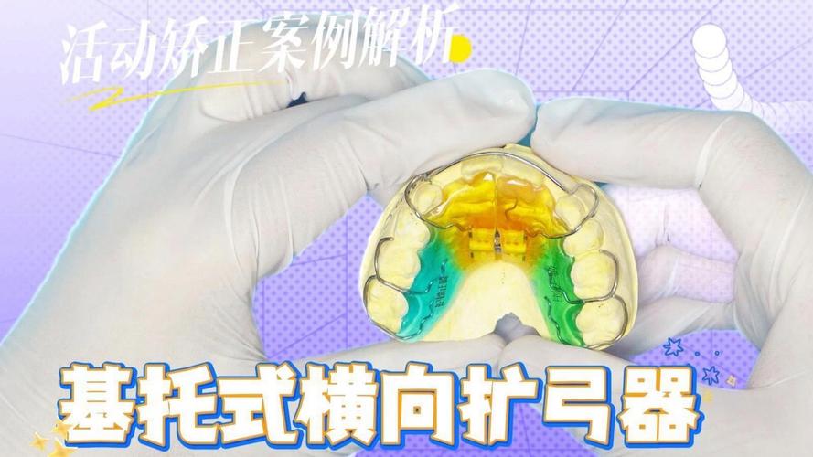 下颌正畸基托制作视频-图1 下颌正畸基托制作视频-图1