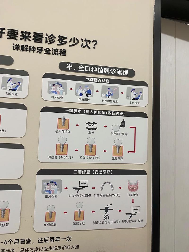 种牙手术前患者需要重点关注哪些注意事项,才能有效规避风险并保障手术顺利推进?-图2 种牙手术前患者需要重点关注哪些注意事项,才能有效规避风险并保障手术顺利推进?-图2