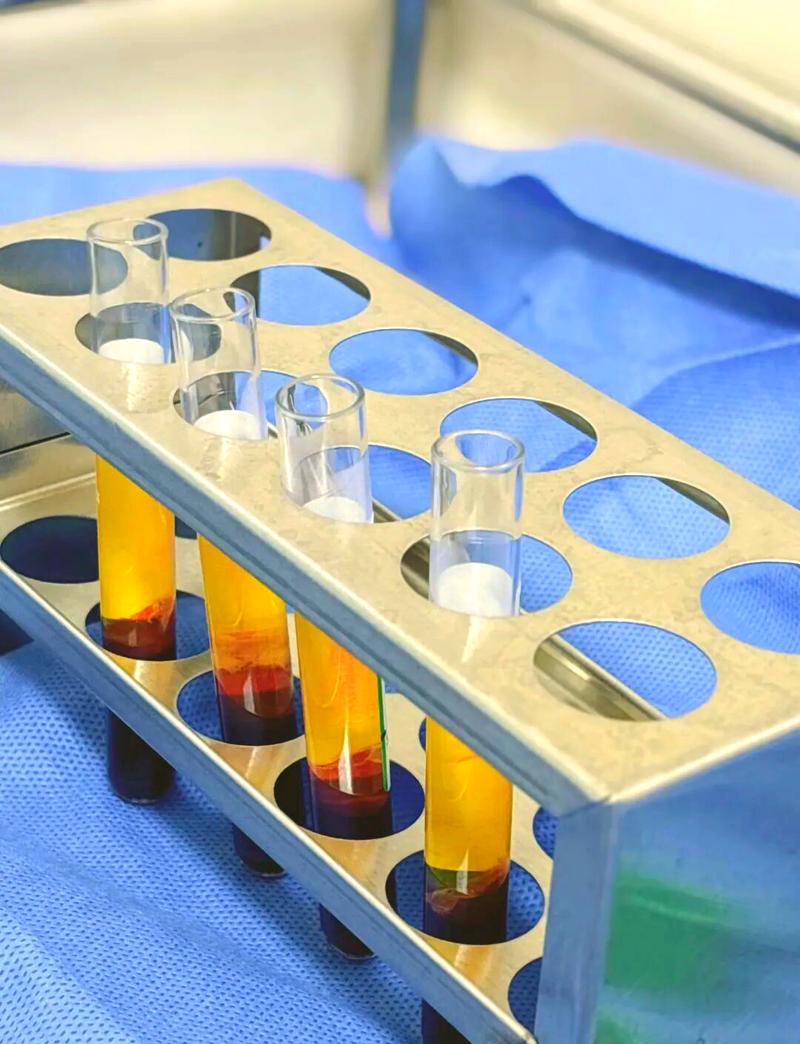 CGF临床应用方法的具体操作流程及不同适应症下的制备参数如何规范？-图3