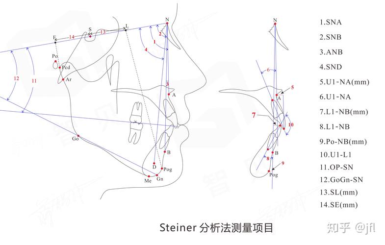 Tweed测量方法在正畸诊断中的核心指标有哪些？不同面部类型下如何优化其测量准确性？-图3