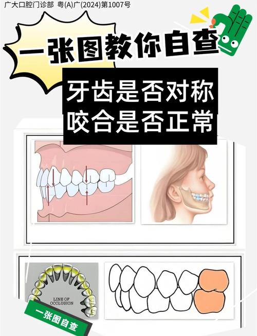 正畸打开深覆合有哪些常用方法？不同方法的适应症和治疗效果如何评估？-图2