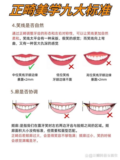 正畸治疗如何通过牙齿排列改善面部美学？其与微笑设计的关联又该如何精准把握？-图2