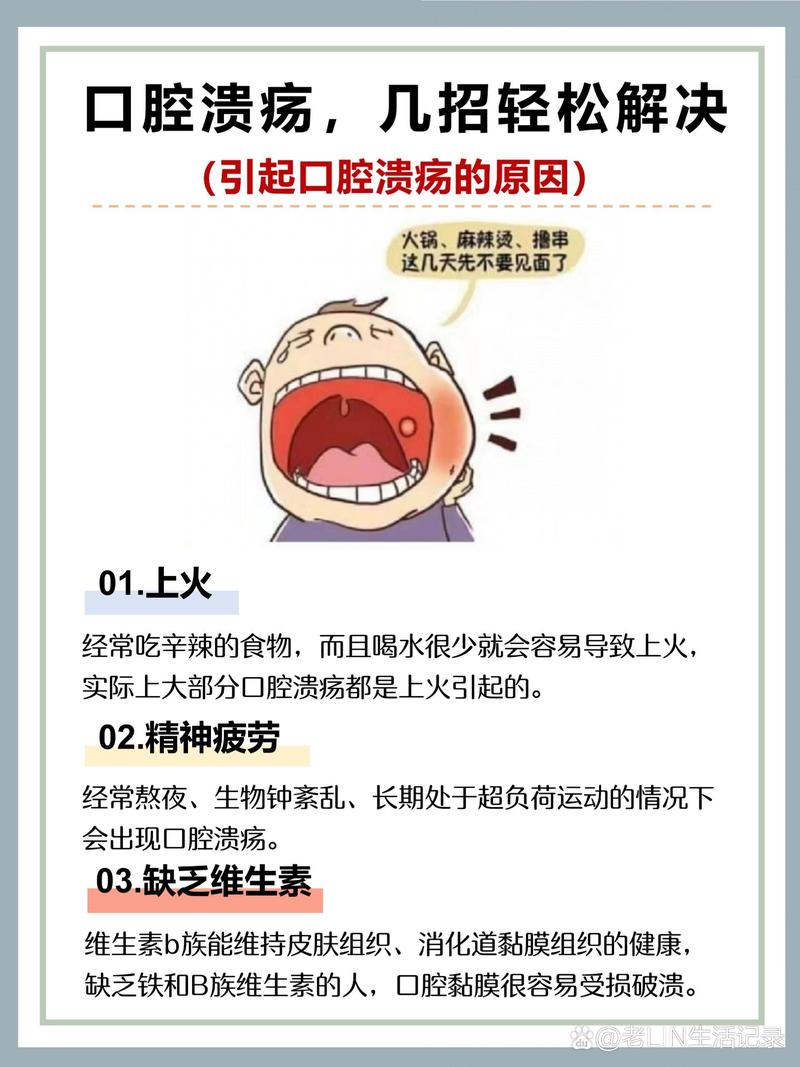口腔炎快速治疗方法真的安全有效吗？不同症状患者如何选择见效快又不伤黏膜的方案？-图1
