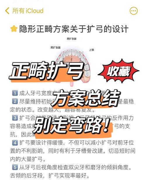 口腔正畸扩大牙弓有哪些常用技术？不同方法的原理、适应症及效果差异如何？-图2