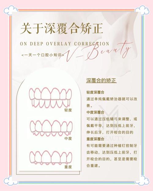 深覆合矫正方法多样，不同患者如何选择最优矫正方案？效果与风险如何平衡？-图3