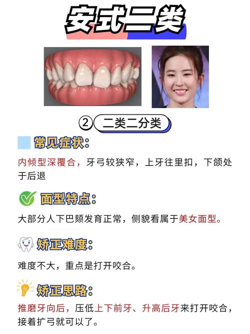 牙齿矫正常见方法有哪些？传统托槽、隐形矫正、舌侧矫正等不同方式分别适合哪些人群，各有哪些优缺点？-图2